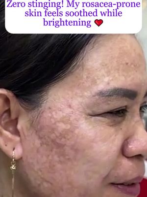 It's time to get rid of your spots