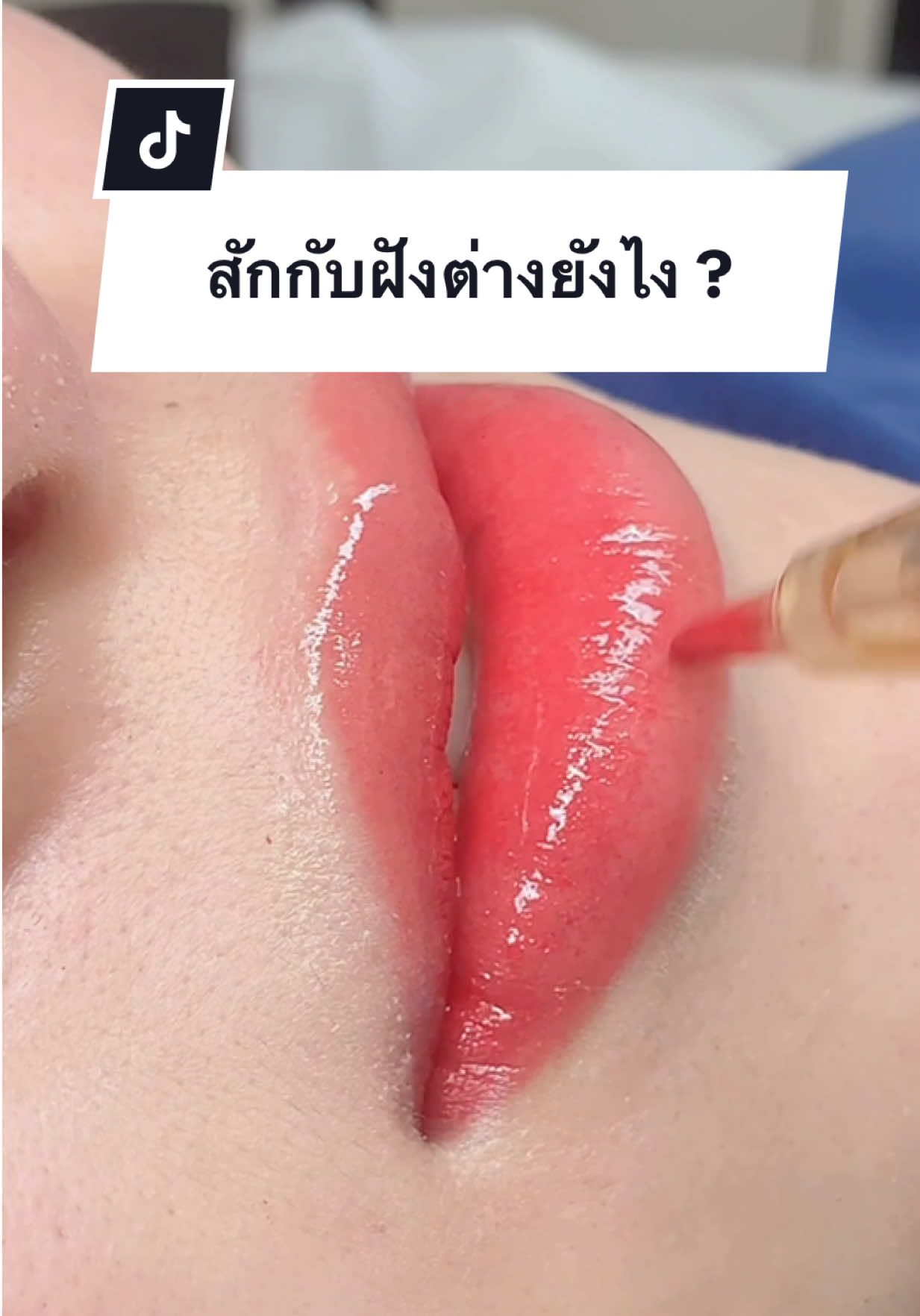 #ฝังสีปากชมพู #ฝังสีปาก #สักปาก #สักปากกับคิม #ฝังสีปากแก้ปากคล้ํา 