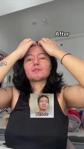 Spil penumbuh rambut di live