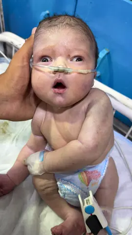 MMC BABY PART 2 caritical condition of newborn Baby#abubakar #newborn #nicu #justbrone #👶 