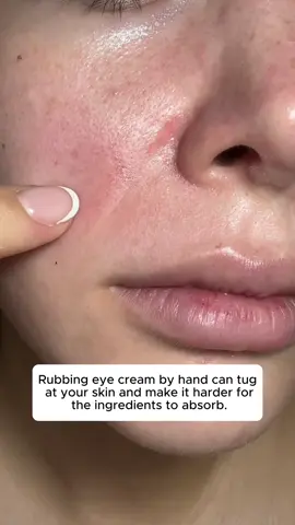 Night owl's best friend!Say goodbye to eye puffiness and dark circles with just a gentle press. #fyp #foryou #eyecream #darkcircles #tiktokmademebuyit