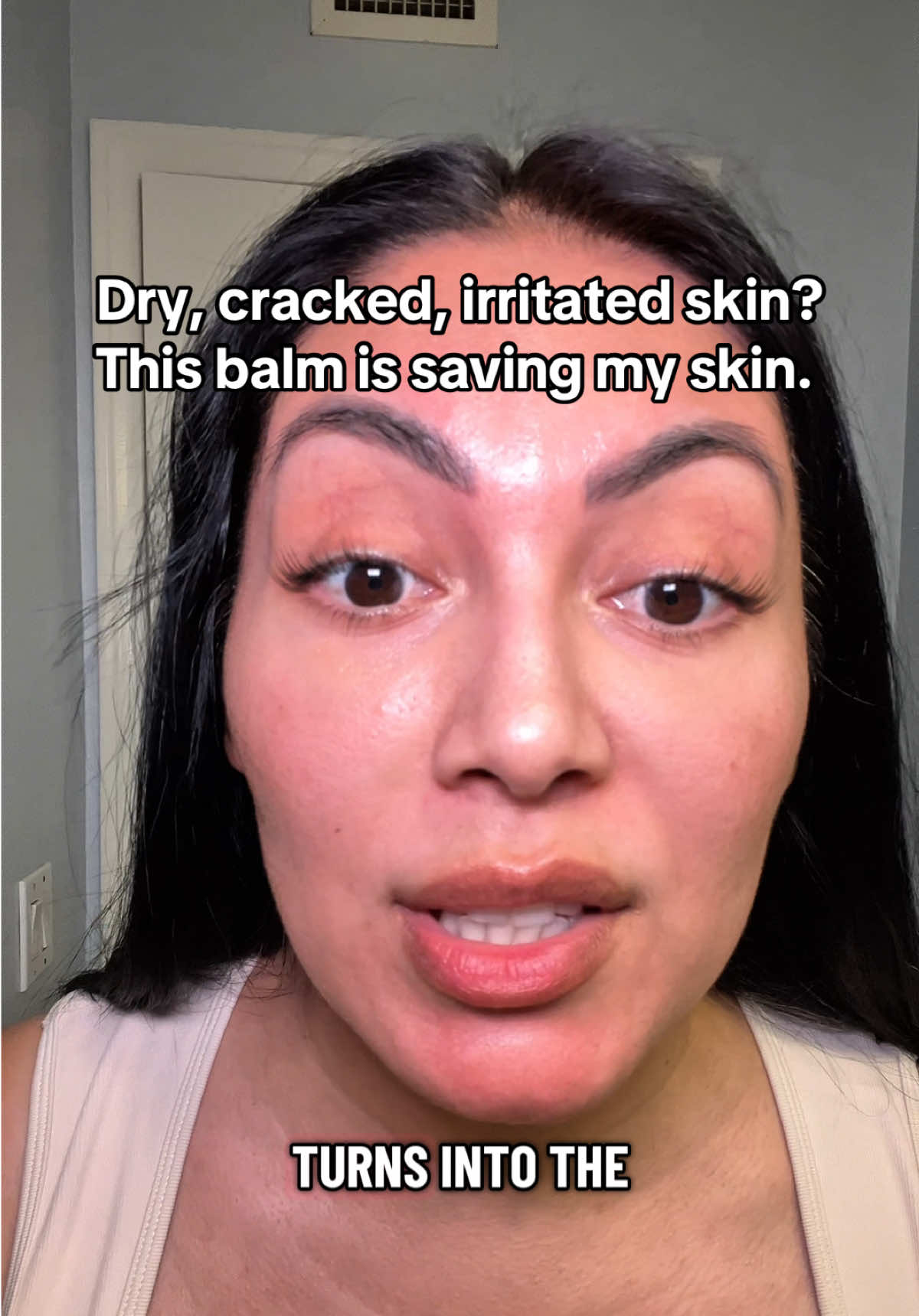 Infused with frankincense & botanical oils 🌱  #creatorsearchinsights Natural balm for dry skin, irritated skin relief, anti-aging frankincense cream, winter skincare essential, chapped skin treatment, botanical body balm. #winterskincare  #dryskin #frankincense #winterskin 