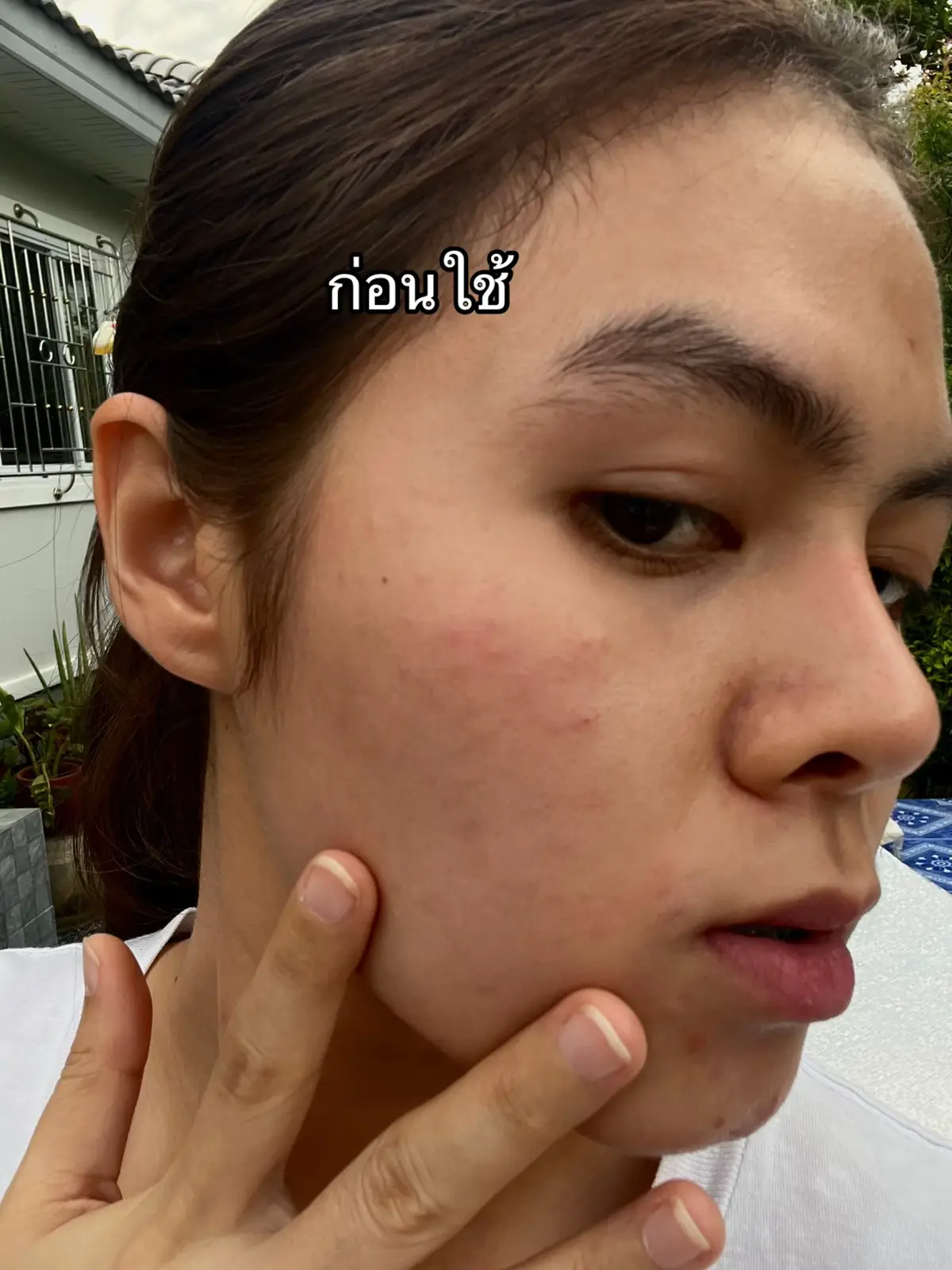 #ครีมน้ำนมข้าว #ครีมน้ำนมข้าวสุรนุช #ครีมลดสิว #skincare #ฟีดดดシ 