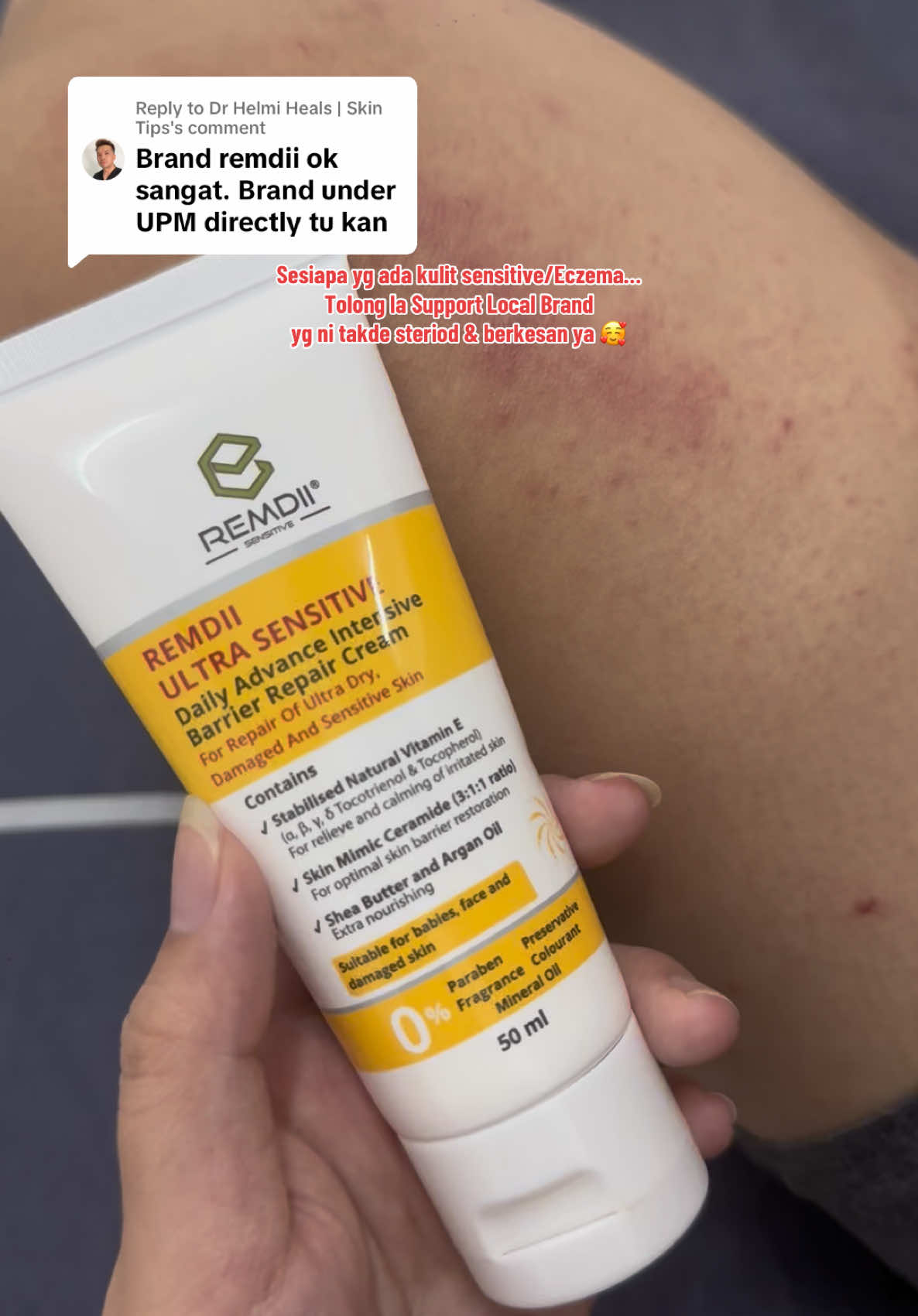 Replying to @Dr Helmi Heals | Skin Tips  🌿 Hi mommies, nak share satu krim yang saya sendiri guna & memang berkesan 💛 Nama dia Remdii Ultra Sensitive Cream – hasil kajian dari UPM 🔬 Paling best, krim ni 100% Steroid Free 😍 jadi selamat untuk bayi & juga orang dewasa. Kulit saya yang sensitif & mudah kering sekarang rasa lebih lembap, tak pedih & makin pulih sebab ada Vitamin E + Ceramide 💧 Memang sesuai sangat untuk siapa yang ada eczema atau kulit mudah iritasi. Saya memang recommend! 🥰 #eczema #foryou #fyp #remdii #baiyaolang 