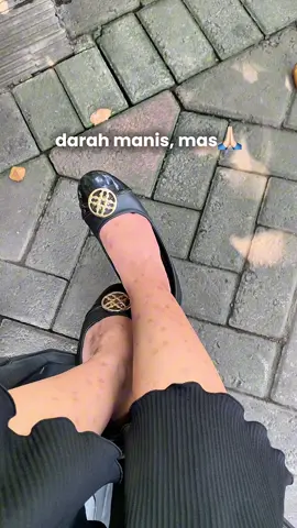 🥺🥺🥺 #fyp #trending #bekasluka #darahmanis #korengan #viral #mulus #dsaviorofficial #foryou #fypシ゚viral #putihbersihglowing #glowing #bodycare 