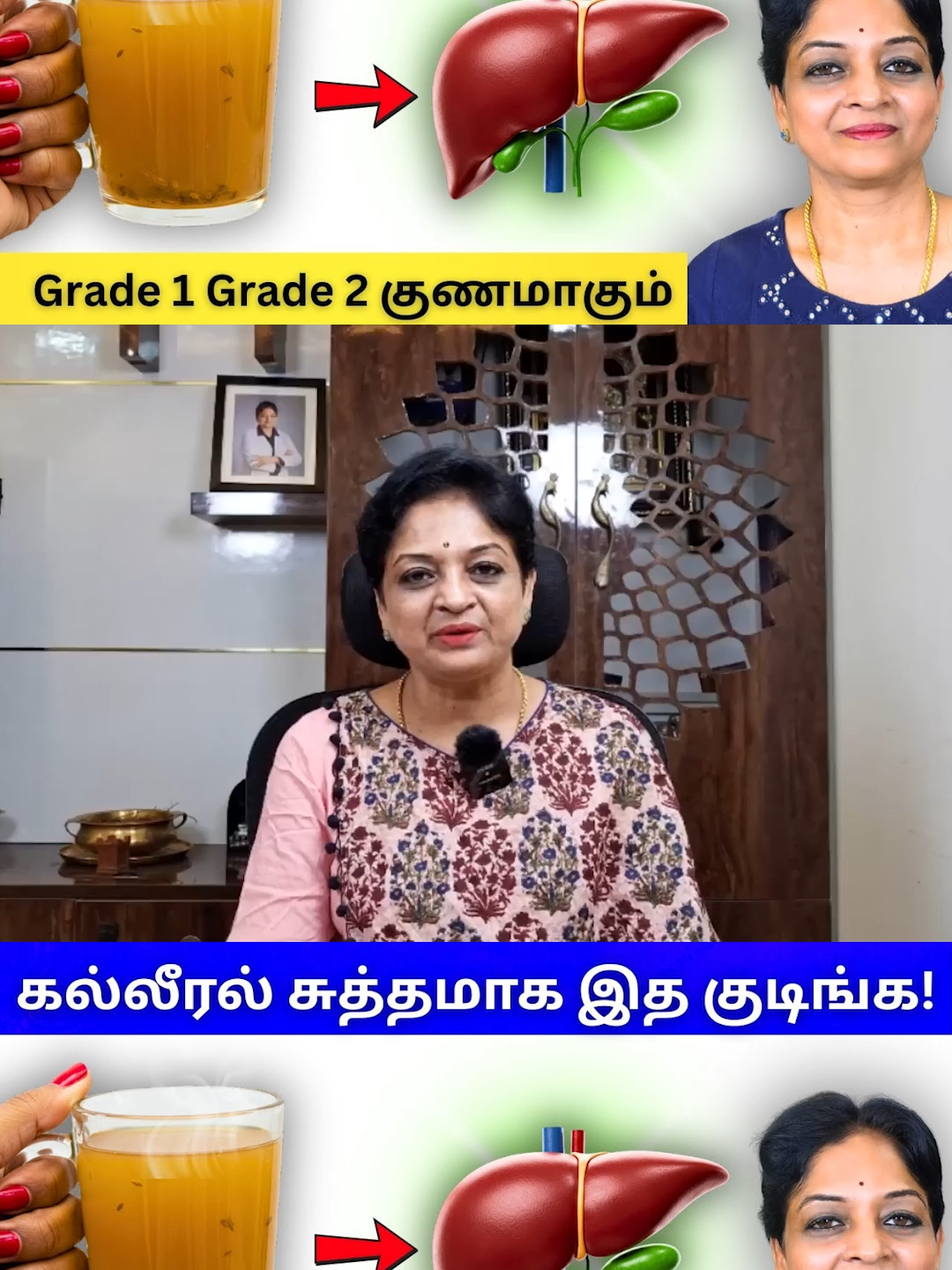 Fatty Liver No Pill Needed! | Fatty Liver க்கு மாத்திரை தேவையில்லை!  Tamil Health Tips I joymusichd  In this video, discover how to manage Fatty Liver naturally without relying on medication. We explain the root causes of fatty liver and its common symptoms. Learn which foods can help reverse fatty liver and promote liver health. Find out the best acupressure points to stimulate liver detoxification. These simple methods can be done at home safely and effectively. Say goodbye to belly fat, tiredness, and bloating linked to liver issues. This video is ideal for both alcoholic and non-alcoholic fatty liver conditions. No more depending on pills – go the natural route for liver care! Don’t miss these powerful Tamil Health Tips to support your well-being. Fatty Liver க்கு மாத்திரை தேவையில்லை! |Tamil Health Tips. Fatty Liver க்கு மாத்திரை தேவையில்லை! | Tamil Health Tips,Doctor Rathi,Dr Rathi,fatty liver,alcoholic fatty liver symptoms,non alcoholic fatty liver symptoms,cirrhosis,liver detox,weight gain,belly fat,bloating,gastritis,tiredness,skin itching,fat,toxins,liver detoxification,fatty liver symptoms,fatty liver grade 1,fatty liver grade 2,natural liver detox,fatty liver treatment,fatty liver prevention,liver acupressure points,tamil health tips,health tips #joymusichd