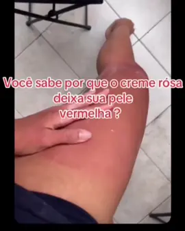Não fique fora dessa ! Entre na modinha que dá resultado !#estrias #usecorpoeverao #cremerosa #celulite #flacidez 