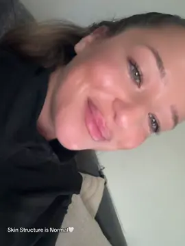 JA mein Gesicht glänzt bis zum geht nicht mehr aber ich war auch schon den ganzen Tag unterwegs 🙈♥️ #girlssupportgirls #fyp #fürdich #trend 