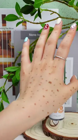 #skincare #outdoorfun#forvou #spots #freckles #tiktokmakemebuy #skin #fyp #tiktokhacks #videowave #tiktokshoplabordaysale #ring #manicure #FrisianFlagENERGOplus #vitamincgold#fathersdaygifts#cozyvibes #effortlessbeauty #TikTokShopSummerTurnUp