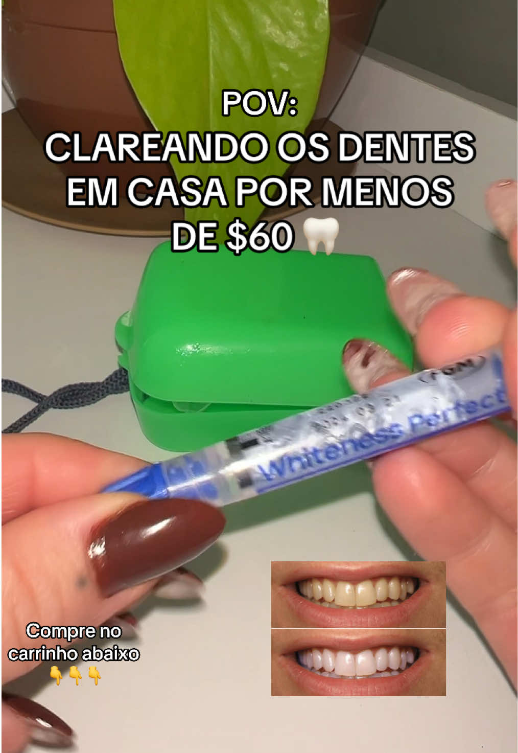 #clareadordental #clareamentodental #clareadorcaseiro #dentesbrancos 