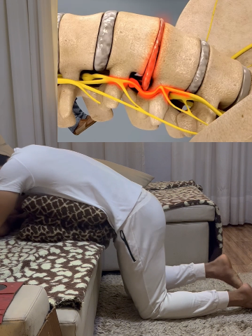 Back pain? #backpain #lowerbackpain #backpainrelief #sciaticarelief 