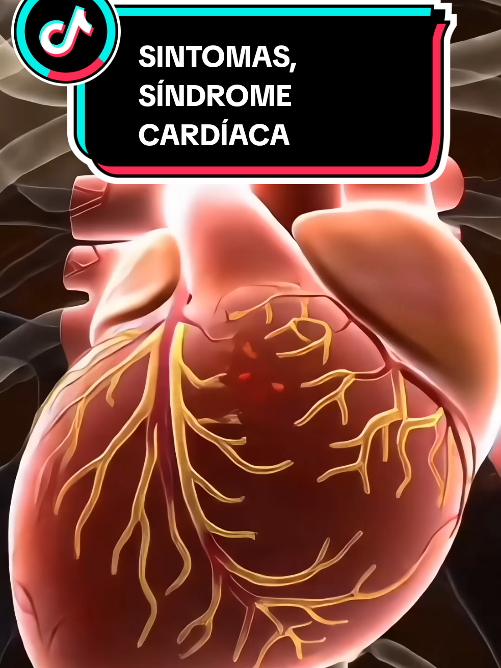 SINTOMAS, SÍNDROME CARDÍACA. #sintomas #doenca 