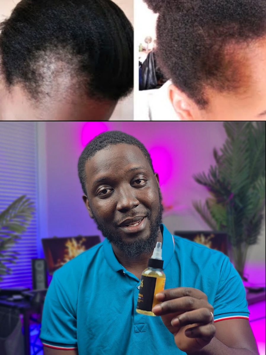 Does Majestic Mint Really Work? | Èske l vrèman mache pou cheve? #MajesticMint #HairGrowth #KwasansCheve #HairCare #swencheve 