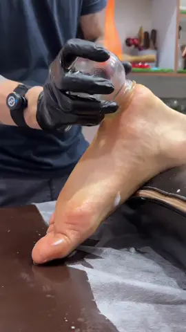 wow hot cupping😍 . . . . .   . . . . . . . . . . . . . . . . . . . . . __________________________________________ #بادکش  #بادکش_درمانی  #بادکش_گرم  #تبریز  #مرند                               