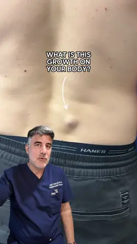 What is this growth in your body? In this case, it’s a large cyst that had been there for over 10 years. We removed it safely in-office. While cysts are usually benign, they can grow, get uncomfortable, or even become infected over time, which is why we often recommend removal.