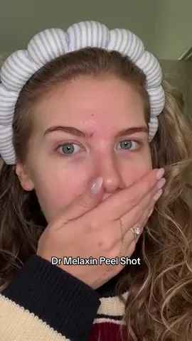 sooo gross but so satisfying at the same time, goodbye blackheads 👏🏻 @Dr Melaxin Official #blackheads #pores #drmelaxin #drmelaxinpeelshot #clearskin 