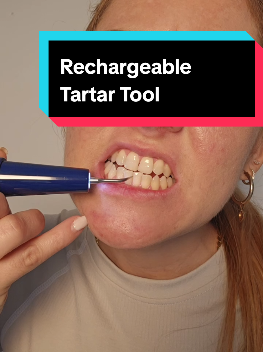 Rechargeable Tartar Tool #oralcaretips  #teethwhiteningkit  #cleanerteeth  #toothbrushes  #toothbrushsterilizerreview 