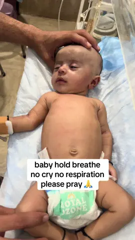 baby hold breathe no cry no response #newbornbaby #unfreezemyacount 