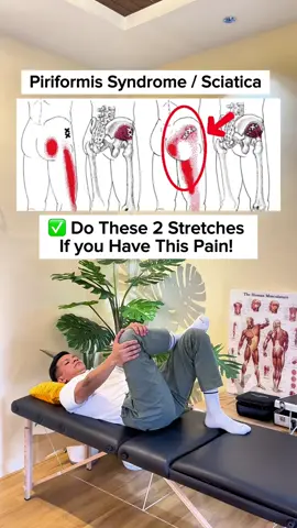 Piriformis Syndrome/Sciatica Pain Relief!!  #physicaltherapy 