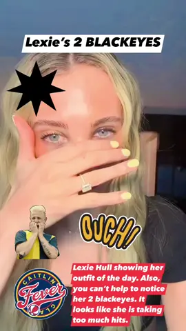 BLACKEYES #cc #caitlinclark #WNBA #indianafever #womensbasketball #basketball #basketballislife #basketballneverstops #basketballhighlights 