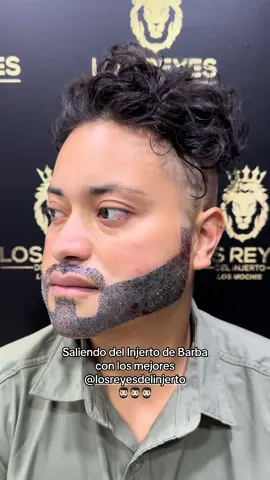 Así se sale plebes de un injerto de barba con los mejores @losreyesdelinjerto 🔥 en 2 meses me injerto en la parte de la papada… a esperar el resultado en unos 4 meses y el final al año 8 meses, bien recomendados 🔥… . . . #viral #barba #cepillin #parati #fyp #playeras #humor #injerto #barbainjertada #tonyaguirre #ozz #ozzbala #maximogrado #christianfelix #fansconfundidos #fans #losreyesdelinjerto #reyesdelinjerto #jaimicotoys #jaimico 