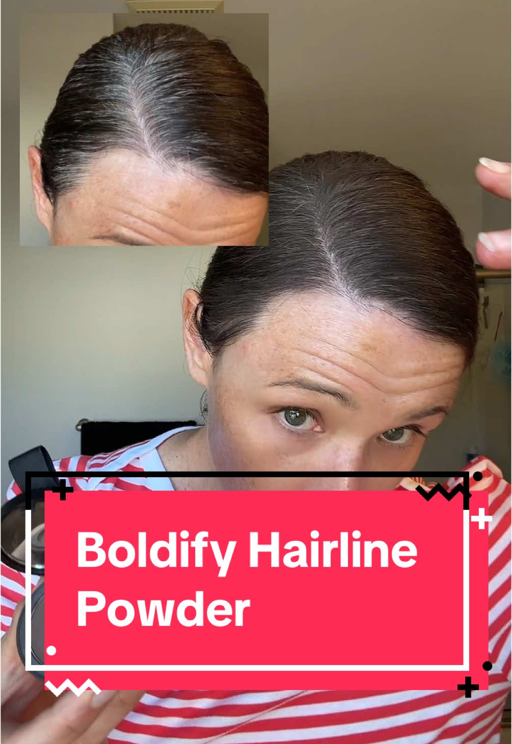 Definitely wish I wasn’t the expert but here I am mastering root coverup! Not many 30-something’s want to rock the gray hair so I’ve been covering my roots between colorings for years. I’ve done all the things - and this is my favorite.  #boldify #boldifyhairlinepowder #grayhair #hairtok #haircolor  @@boldify  