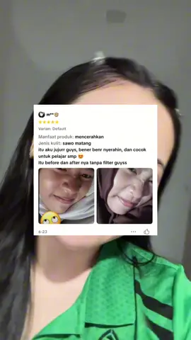 kapan kalian mau cobain kjoel dan glowing barengg?? #kjoel #kjoelskincare #skincareviral #skincaremurah #kjoelskincarebpom 