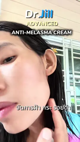 Dr.Jill Advanced An-ti Melasma Cream #ครีมทาฝ้าDrJiLL #ไม่มีฝ้าเท่ากับหน้าเด็ก #ตัวจบฝ้าท้าพิสูจน์28วัน  @คุณปุณรีวิว 