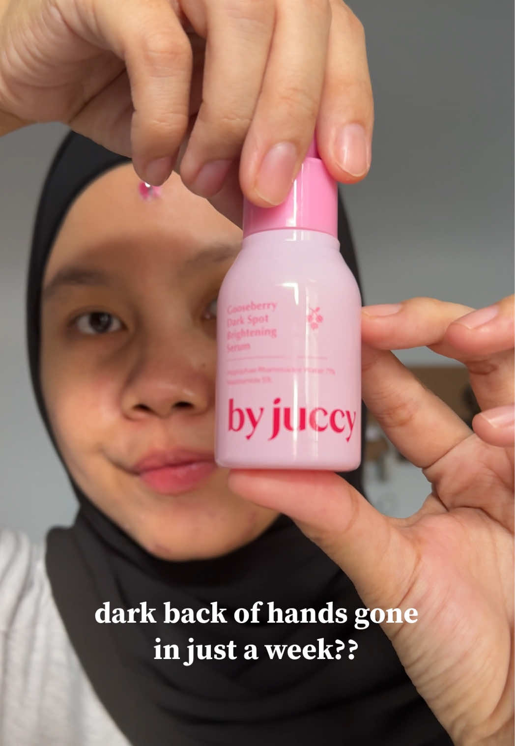 dark back of hands??!!! gone in just 7 days👀 #byjuccy #brightening #darkspots #kbeauty #glowingskin 
