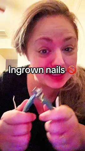 Nail clippers that actually cute thick nails and help with ingrown nails #ingrowntoenail #nailclippers #nailset #thicknails 