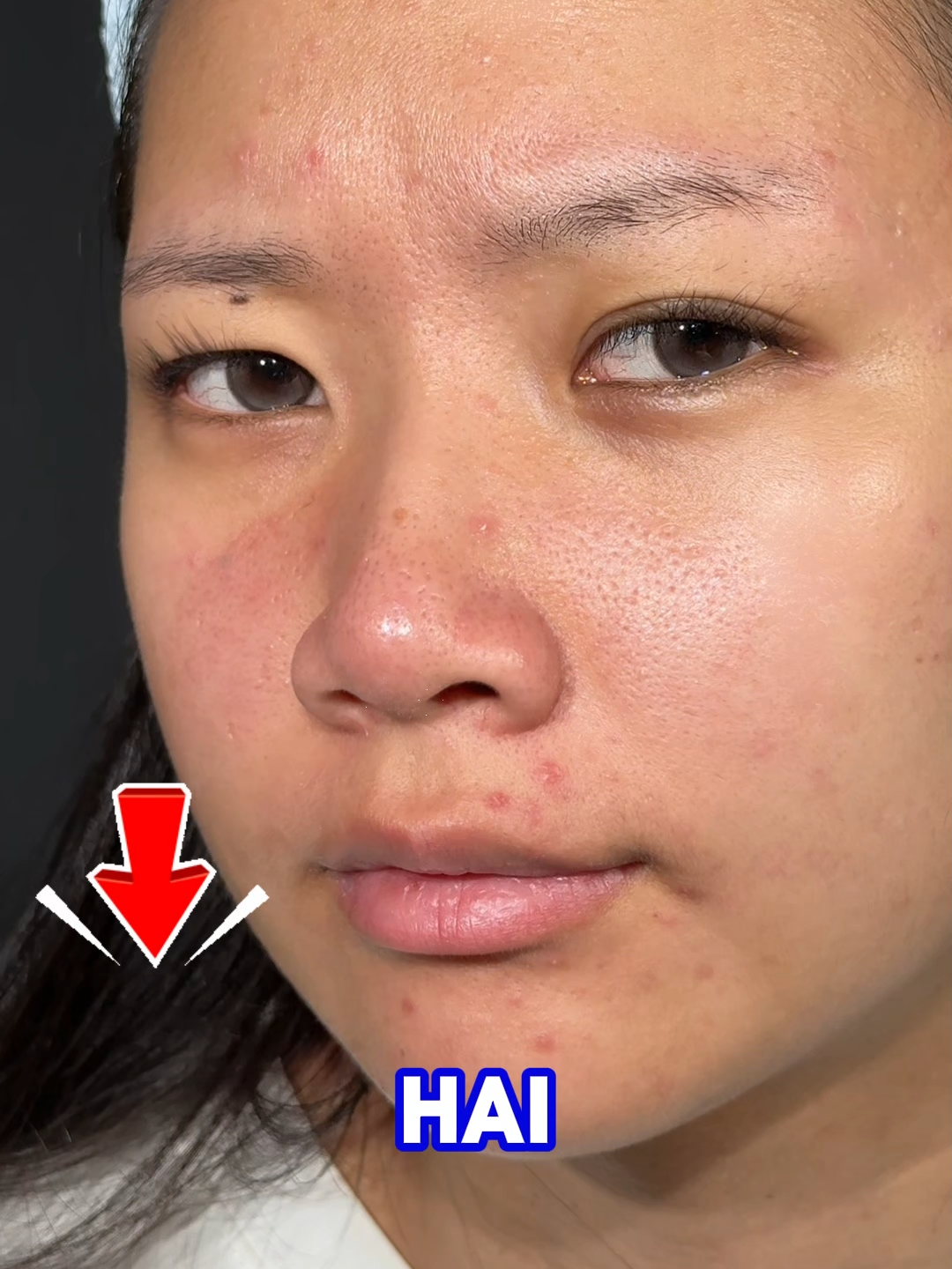 Jika kulit wajahmu kusam, banyak noda, dan hitam kekuningan yang tidak kunjung membaik, kamu harus coba pembersih wajah ini #pembersihwajah #Rekomendasiprodukbagus #murah #tiktokshop
