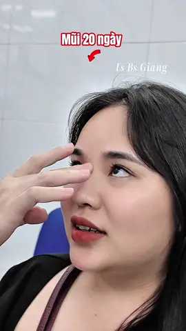 Dáng mũi ai cũng khen  #bsgiangthammy #bsgiangbvvietduc #vdiamond💎 #taohinhthanhbung #muisline #nângmũicấutrúc #dangmui #muidep #nangmuiantoan #nangmui #catcanhmui #nangmuisuntai #xuhuong #nangmuiphongthuy68  