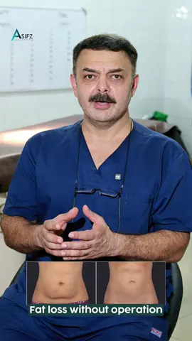 Fat loss #aestheticprocedure #asifzaesthetics #drasif #fyp 