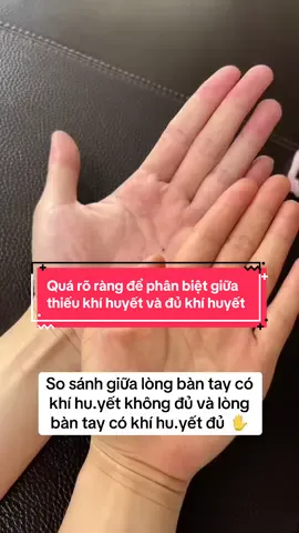 Quá rõ ràng để phân biệt giữa thiếu khí huyết và đủ khí huyết 😄 #xuhuong #dongy #bstungyhct #yhct 