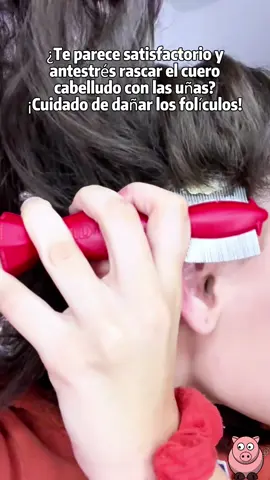 ¿Picores en la cabeza y caspa? ¡Deja de rascarte! Prueba champú con sulfuro de selenio. Realmente es muy bueno paracontrolar la grasa y eliminar la caspa.  #scalpacne#oilyhair #antidandruff #scalpItch#nippori 