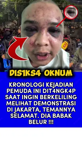 Diduga Salah T4ngk4p Pemuda Ini menjadi Bulan-Bulanan P3mvkul4n Oleh Oknum Kepolisian‼️
