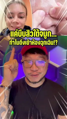 บีบสิว‼️จนเข้าห้องฉุกเฉิน‼️ #tiktokuni #storytelling #เรื่องแปลก #acne #นักพากย์ตั่วเฮีย 