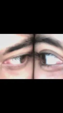 We are siblings 👀 #CapCut #trending #eyes #foryouuuu #viralvideo @For You @TikTok Tips @TikTok Bangladesh 