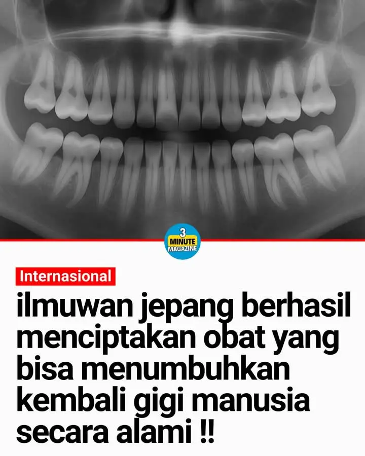 Penelitian terbaru dari tim yang dipimpin oleh Dr. Katsu Takahashi di Medical Research Institute Kitano mengindikasikan bahwa penghambatan protein tertentu dapat merangsang pertumbuhan gigi baru. Studi pada model hewan (tikus) menunjukkan keberhasilan terapi ini dalam memicu pertumbuhan gigi, dan uji klinis pada manusia saat ini tengah dipersiapkan dengan proyeksi penggunaan klinis pada tahun 2030. Temuan ini didasarkan pada adanya “benih gigi ketiga” pada manusia, yang umumnya tidak berkembang. Jika diaplikasikan secara klinis, pendekatan ini berpotensi merevolusi perawatan gigi dengan menghadirkan metode regeneratif alami sebagai alternatif implan maupun prostetik. #japan #medical #facts #knowledge #scientist #viralpost #trendingpost