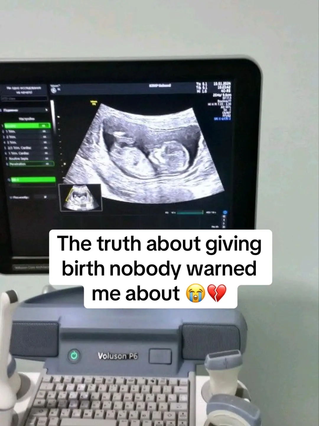 #BirthTruths #LaborAndDelivery #PostpartumReality #ThingsNoOneTellsYou #NewMomJourney