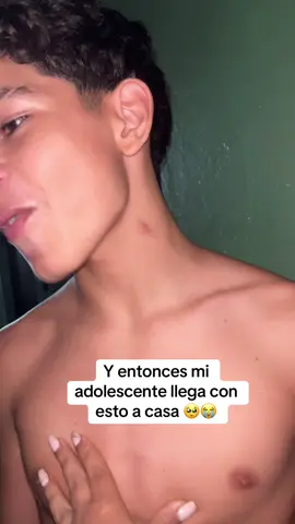 Disque los zancudos en el campo de futbol pican así :( #fyp #adolescentes #mamaehijo #tiktok 
