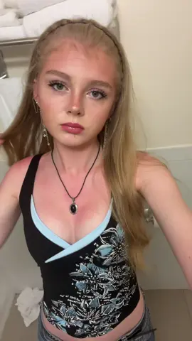 Little sunburnt