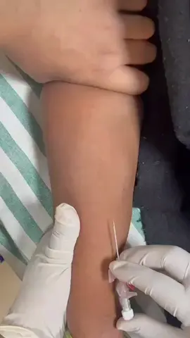 Cannulation #cannula #nurse #icunurse #nursingstudent #ممرض 