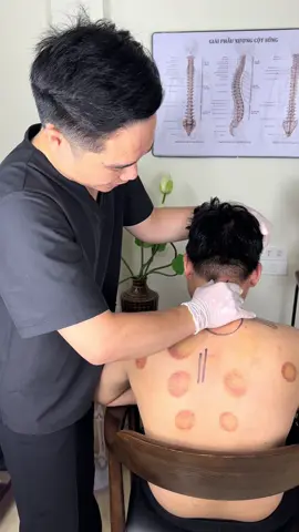 Viên vai gáy thái dương giảm đau mỏi cổ vai gáy, lưu thông khí huyết #vienvaigaythaiduong #xuhuong #chamsocsuckhoechudong #vienvaigaythaiduonghotrogiamdau #vienvaigayxuongkhop 
