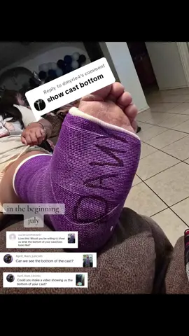Replying to @dmyrie4 @April_Ham_Lincoln @user3622519340847  #castlife #brokenankle #comment #weird #cast