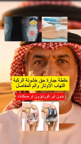 #خشونة_الركبة #دهان_الحنظل #كريم_المفاصل #الم_الظهر #كريم_طبيعي هذي عشبة الحنظل 🌿، قوية جداً ومعروفة من زمان بفوائدها في تخفيف آلام المفاصل والظهر. نستخدمها خارجياً فقط بعد تحضيرها بطريقة خاصة، وممنوع أكلها لأنها قد تسبب مشاكل صحية خطيرة. تصحى من النوم وحاس إن ركبتك أو ظهرك يعورك؟ الألم ما يخليك تتحرك براحة. دهان الحنظل الطبيعي، وصفة معروفة من زمان لتخفيف آلام المفاصل والركب والظهر. سريع الامتصاص ويعطيك راحة على طول. مكوناته طبيعية، يخفف التهابات وتورّم ويسهّل عليك الحركة. جربه اليوم وخل يومك أخف بلا وجع – اطلبه الحين يوصلك لين باب بيتك. #دهان #الحنظل #التهابات_المفاصل #خشونة_الركبة #خشونة_الركب #سنام_الجمل #سنام_الجمل_فوائد #خشونة_الرقبة #التهابات_الكتف #عرق_النسا #عرق_النساء_في_٣٠_30_ثانية_اسفل_الظه #ألم_أسفل_الظهر #ألم_الرقبة #السعودية🇸🇦 #الدمام_الخبر_الشرقيه #السعودية #الدمام_الخبر_الاحساء_الجبيل_الظهران #الرياض_الان #الرياض_جده_مكه_الدمام_المدينه #جدة_الان #الإبهر #الدمام_الخبر_الشرقيه_الاحساء_الهفوف 
