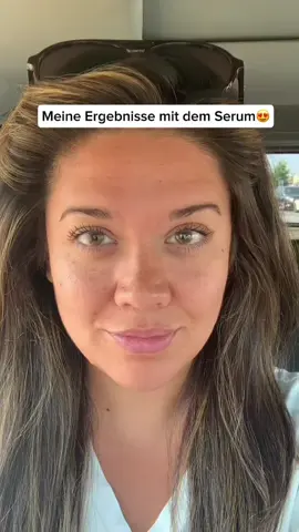 Wenn dein Serum wirkt wie Botox, aber dein Konto happy bleibt 😂💧 #beautyhacks #antiaging #viral #fypシ #skincareproductsmusthave 