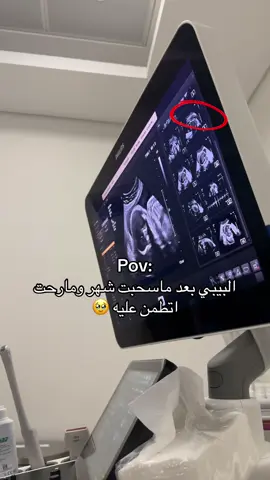 اسفه 🤣🥹 .. #رياكشن #حوامل_الشهر_التاسع #حوامل 