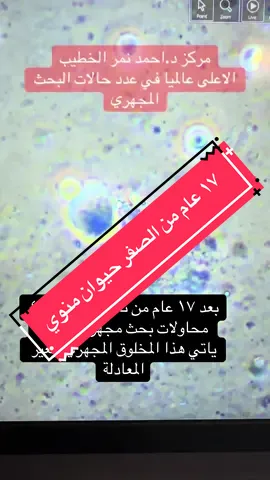من الصفر يبدء الامل #احمد_نمر_الخطيب  #بحث_مجهري  #تقنية_روزي  #متلازمة_كلاينفلتر  #صفر_حيوان_منوي     
