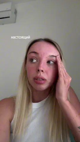 Пусть как можно больше владельцев котиков узнают, что такое может быть и уберегут своих любимцев от несчастного случая🙏🏻
